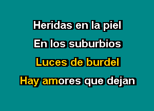 Heridas en la piel
En Ios suburbios

Luces de burdel

Hay amores que dejan