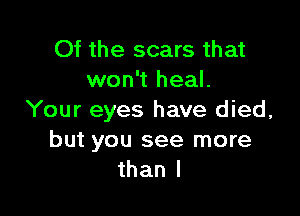 Of the scars that
won't heal.

Your eyes have died,
but you see more
than I