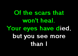 Of the scars that
won't heal.

Your eyes have died,
but you see more
than I