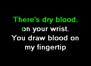 There's dry blood,
on your wrist.

You draw blood on
my fingertip