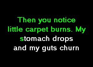 Then you notice
little carpet burns. My

stomach drops
and my guts churn