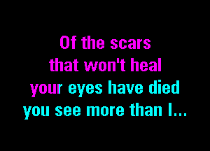 0f the scars
that won't heal

your eyes have died
you see more than I...