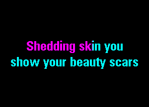 Shedding skin you

show your beauty scars