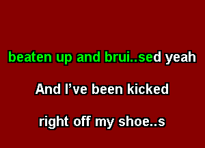 beaten up and brui..sed yeah

And We been kicked

right off my shoe..s