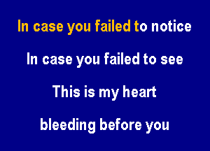 In case you failed to notice
In case you failed to see

This is my heart

bleeding before you