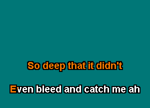 So deep that it didn't

Even bleed and catch me ah