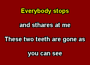 Everybody stops

and sthares at me

These two teeth are gone as

you can see