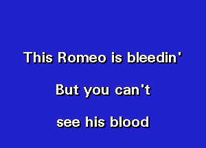 This Romeo is bleedin'

But you can't

see his blood