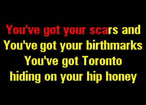 You've got your scars and
You've got your hirthmarks
You've got Toronto
hiding on your hip honey