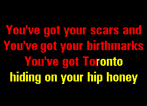 You've got your scars and
You've got your hirthmarks
You've got Toronto
hiding on your hip honey