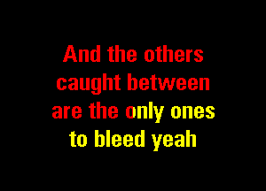 And the others
caught between

are the only ones
to bleed yeah