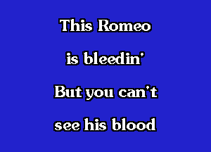 This Romeo

is bleedm'

But you can't

see his blood