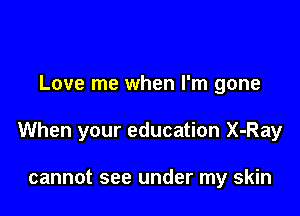 Love me when I'm gone

When your education X-Ray

cannot see under my skin