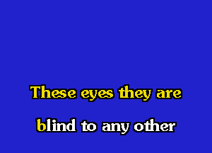 Thme eyes they are

blind to any oiher