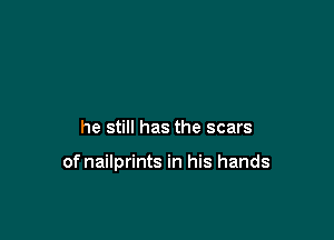 he still has the scars

of nailprints in his hands