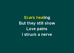 Scars healing
But they still show

Love pains
I struck a nerve