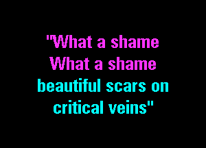 What a shame
What a shame

beautiful scars on
critical veins