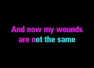 And now my wounds

are not the same