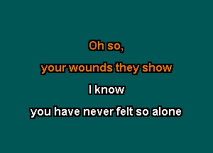 Oh so,

your wounds they show

I know

you have never felt so alone