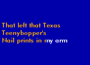 That left that Texas

TeenyboppeHs
Nail prints in my arm