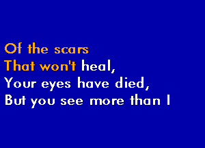 Of the scars
That won't heal,

Your eyes have died,
But you see more than I