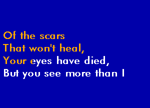 Of the scars
That won't heal,

Your eyes have died,
But you see more than I