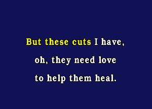 But these cuts 1 have.

oh. they need love

to help them heal.